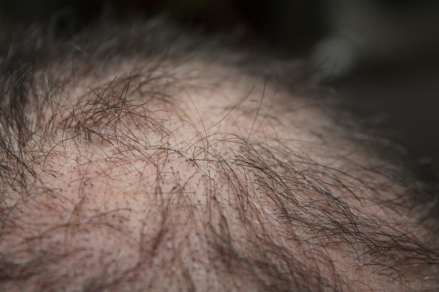 Learn all about how peptides can help with hair loss